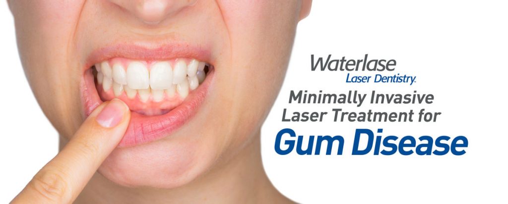 Best Laser Gum Disease Treatment provider in Mesa, AZ area