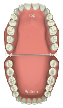 Best Porcelain Veneers Treatment provider in Mesa, AZ area